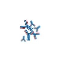 antibody-hsv